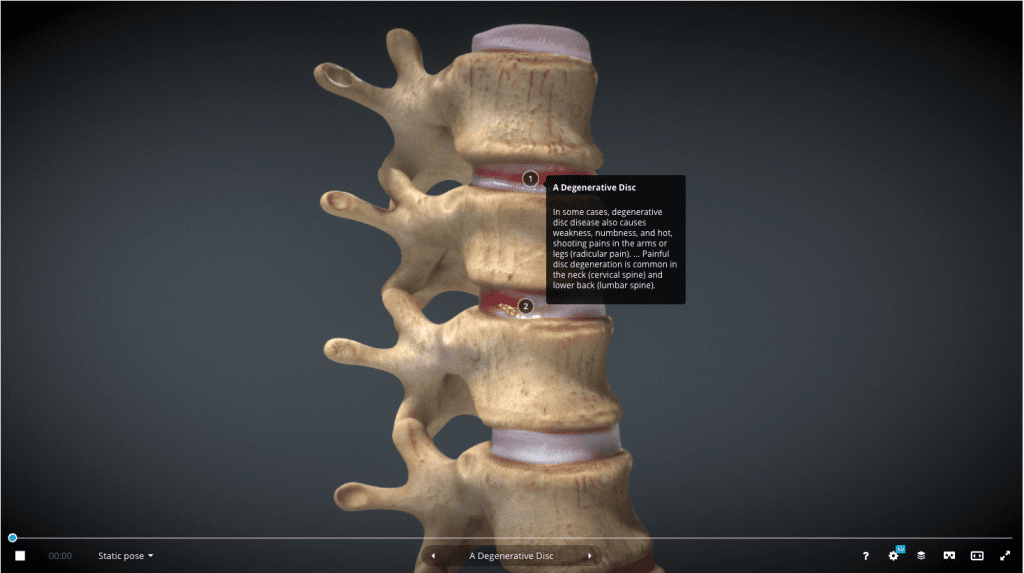 3D model of human spine